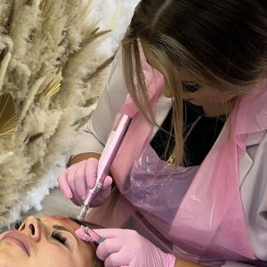 Dermapen- Skin Needling